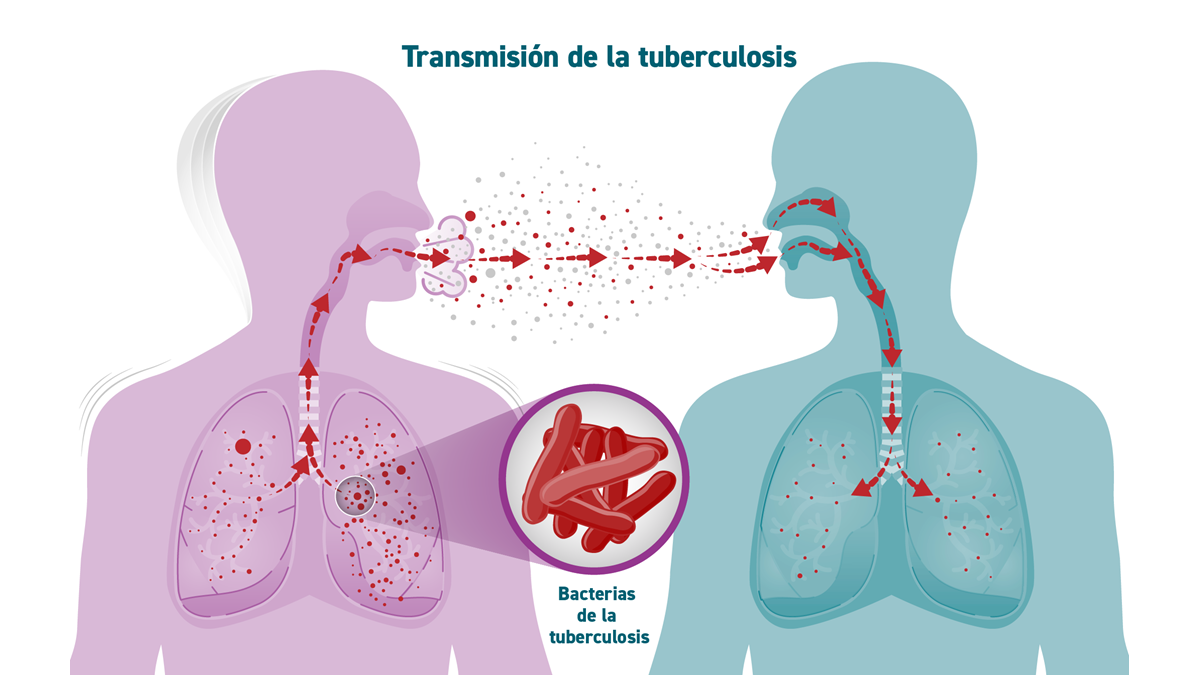 bacteria tuberculosis
