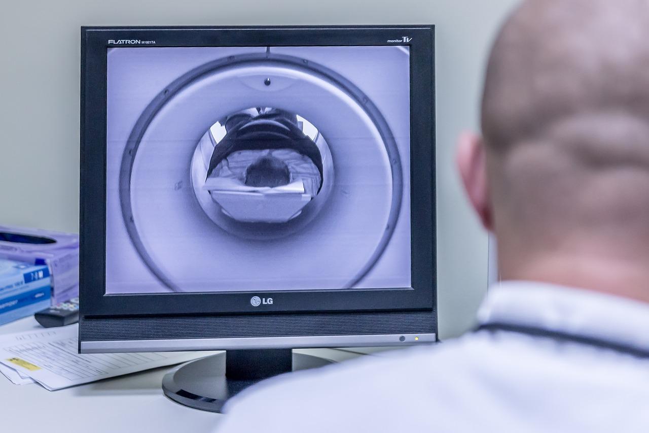 Equipo de resonancia magnética en un entorno hospitalario, fundamental para el diagnóstico del adelgazamiento del cuerpo calloso.