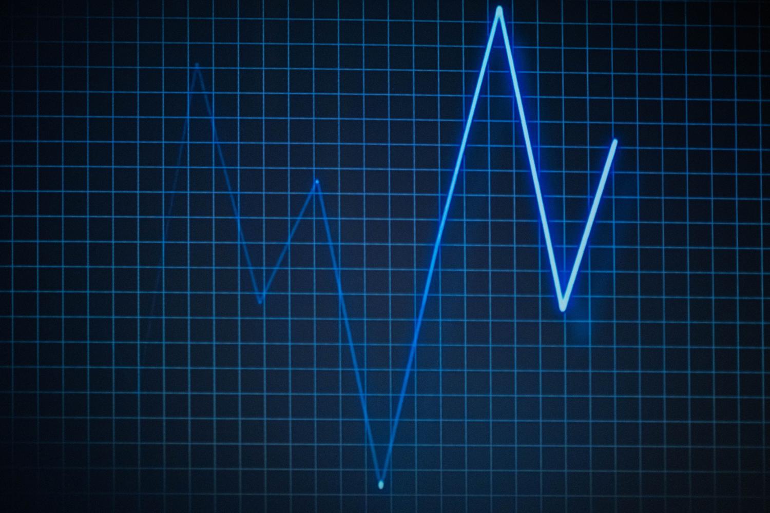 Representación digital de una señal de electrocardiograma (ECG) sobre un fondo de cuadrícula azul, simbolizando señales biológicas.