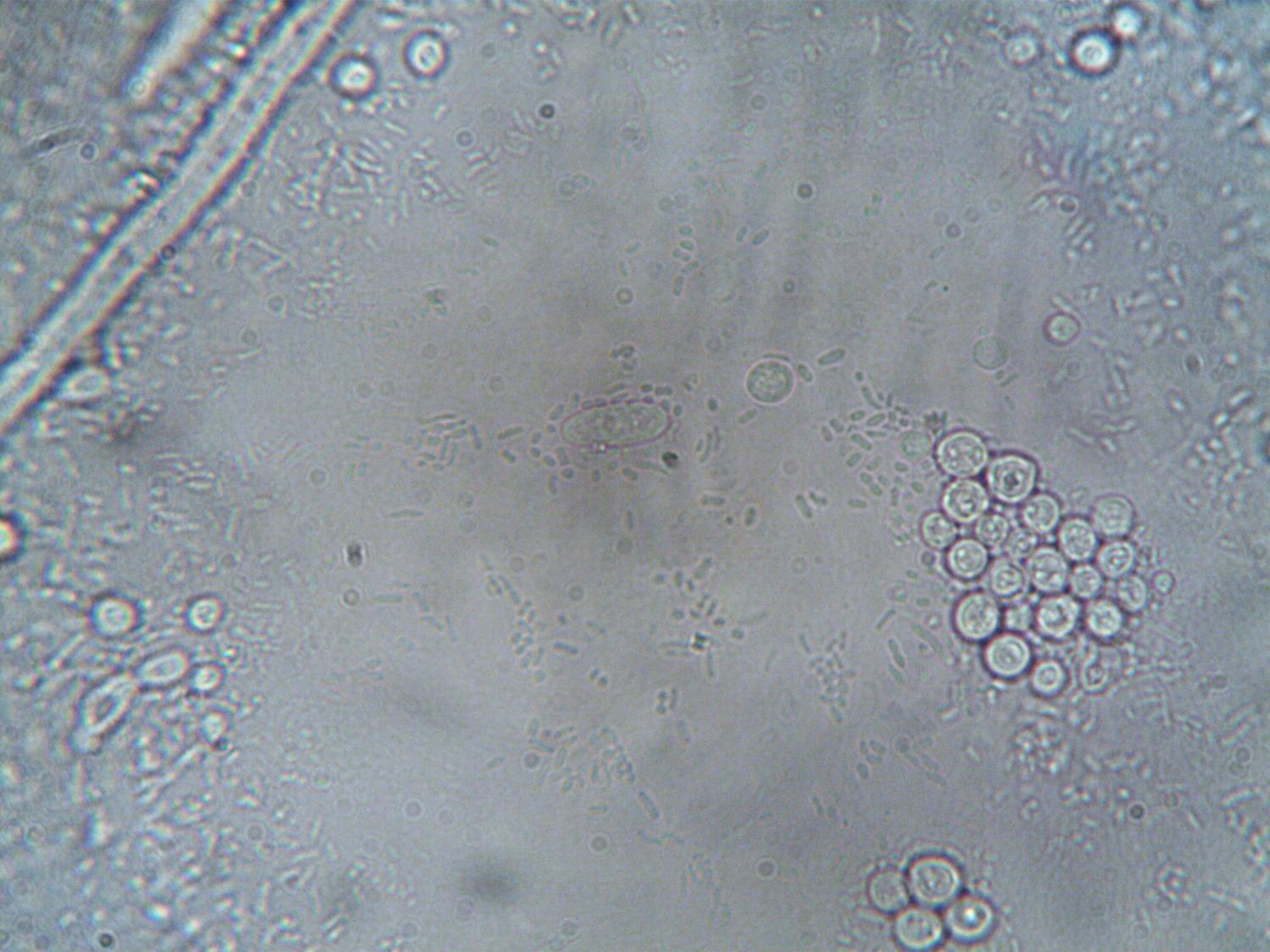 Imagen de microscopio de alta resolución que muestra estructuras celulares y organismos, ideal para ilustrar la biopsia líquida.