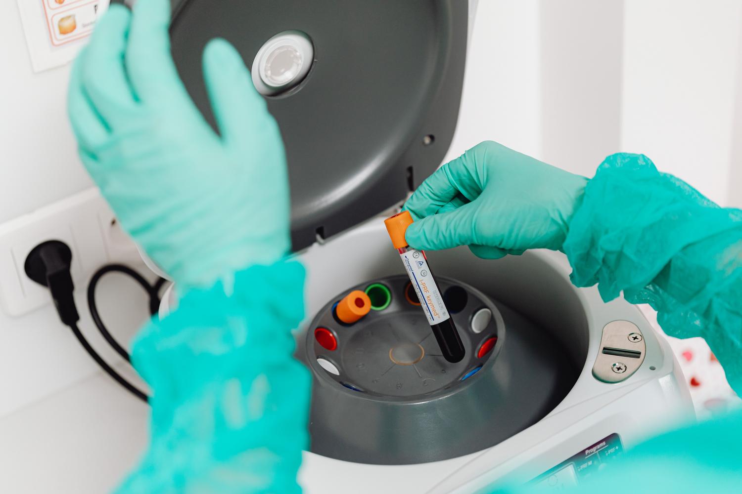 Técnico de laboratorio utilizando una centrifugadora para el análisis de muestras de sangre.