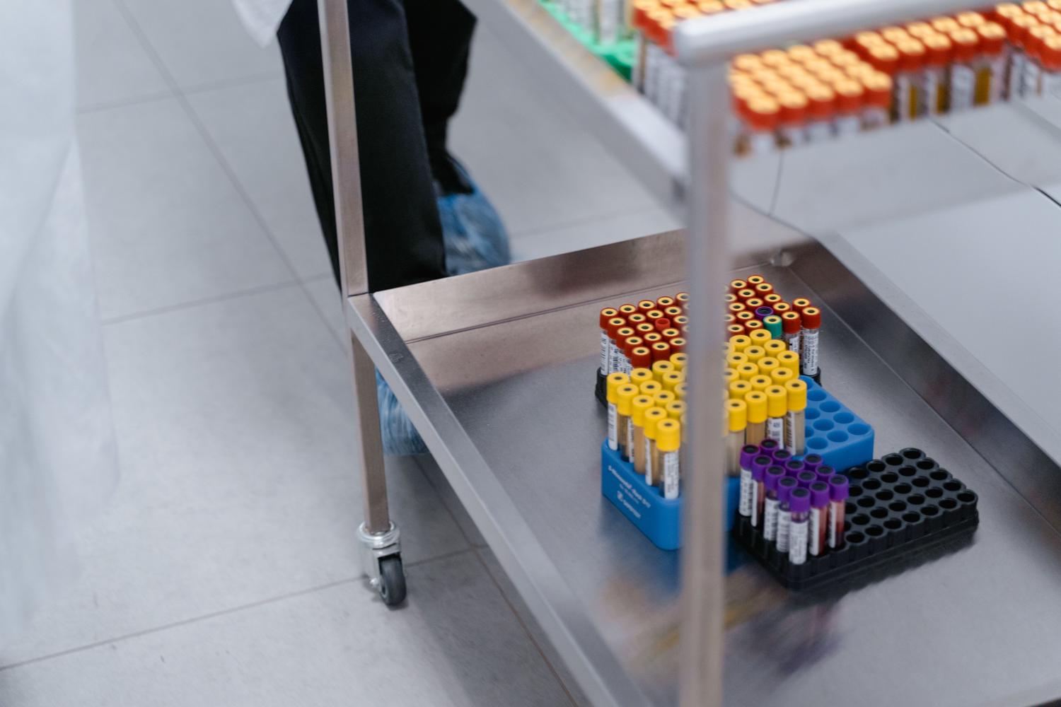 Muestras de sangre organizadas en un rack de laboratorio listas para su análisis bioquímico.