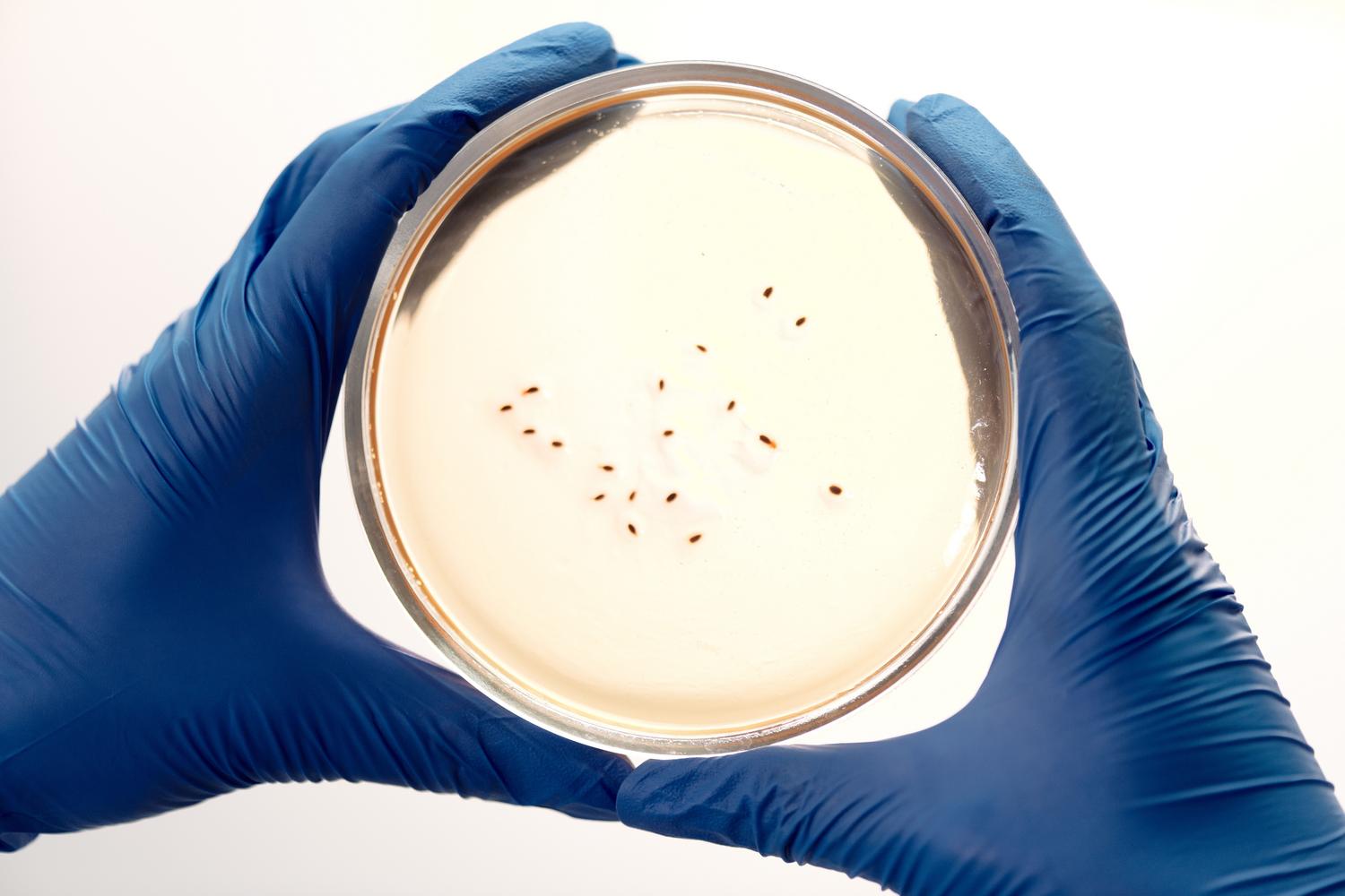 Científico analizando colonias bacterianas en placas de Petri en un entorno de laboratorio de microbiología.