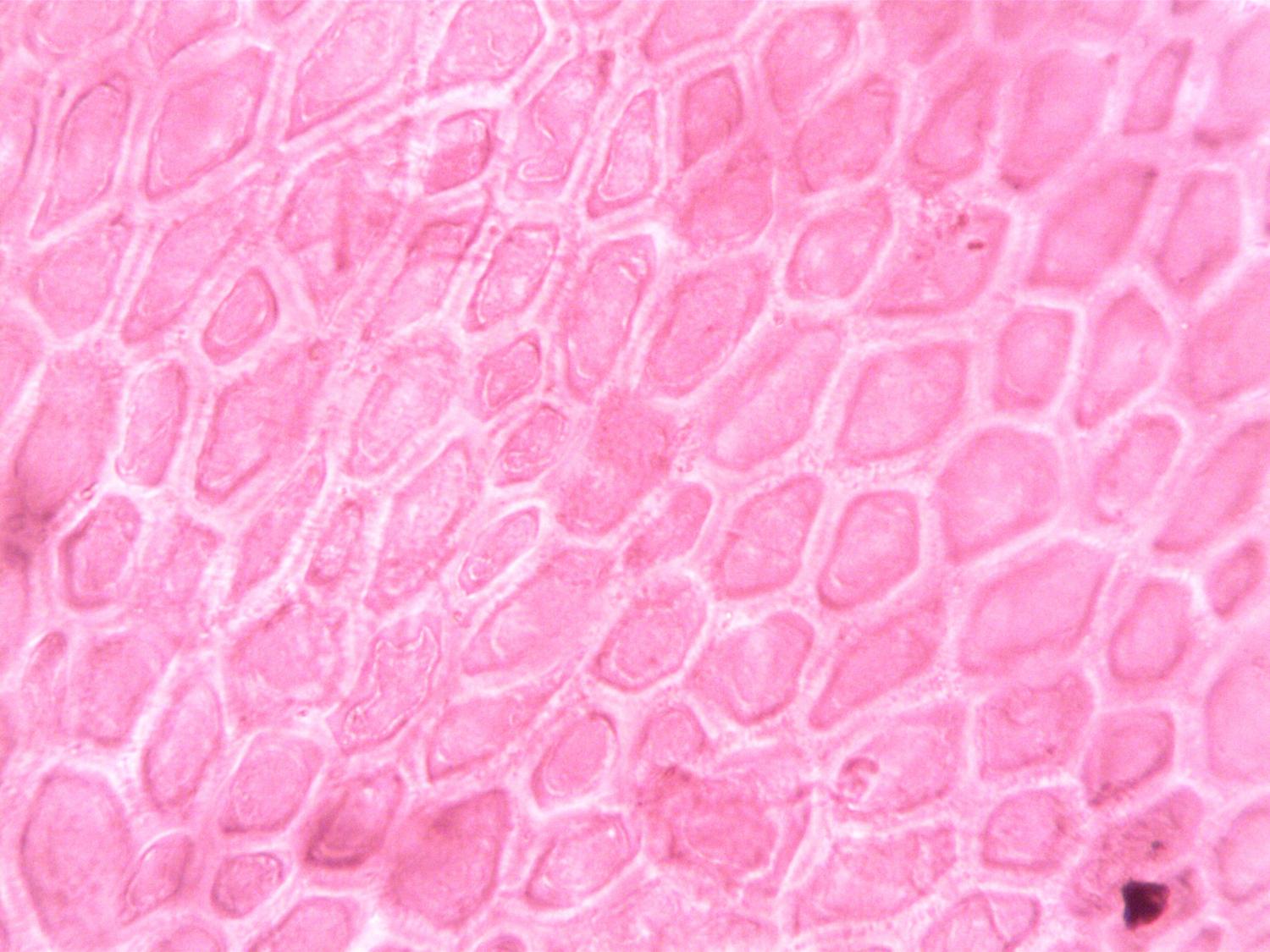 Vista microscópica de estructuras celulares en tonos rosados, representativa de la apariencia de los oncocitos con tinción de hematoxilina-eosina.